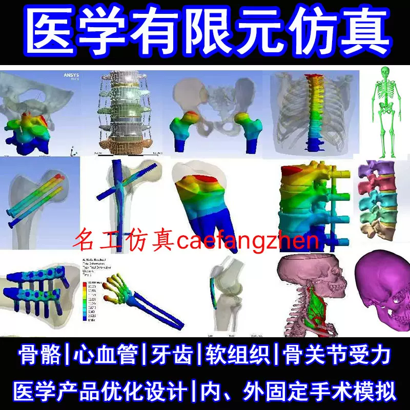 医学有限元颈腰椎脊柱口腔牙骨科生物力学仿真分析ct重建模型代做 