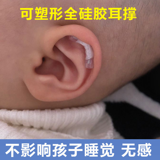 Baby Ear Correction Newborn Children's Auro Correction Patch Correcting Shapeing Forming Create outer earlobe baby