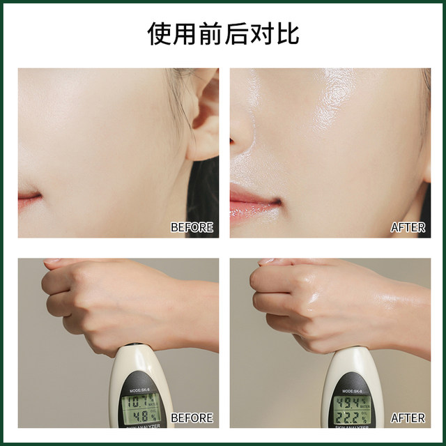 Xie Xintong Korean AROH centella asiatica mask hydrating aftersun