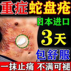 Non-Specific Medicine for Post-Herpes Zoster Neuralgia, Topical Ointment for Snakebite, Pain Relief and Itch Relief, Non-Herbal Cure for Snakebite, Non-Immunoglobulin Treatment