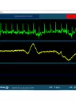 ADS1292 mô-đun ECG cảm biến điện tâm đồ kênh đôi theo dõi hô hấp thu thập nhịp tim 20 bảng phát triển cạnh tranh điện tử