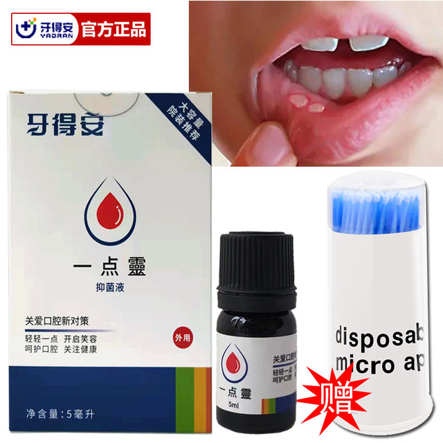 Gideal Yidianling 5ml Is Used For Oral Inflammation Sore Mouth Tongue