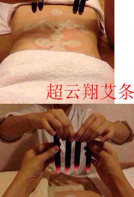 云翔艾灸