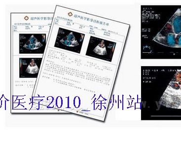 医学影像工作站/平价医疗设备